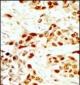 DAPK2 Antibody (N-term)