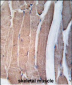 DAPK2 Antibody (N-term)