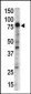 DCAMKL1 Antibody (N-term)