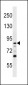 DCAMKL1 Antibody (N-term)