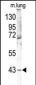 MAPK12 Antibody (Center)