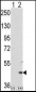 MAPKAPK2 Antibody (N-term)