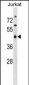 MAPKAPK2 Antibody (N-term)