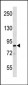 MARK Antibody (C-term)