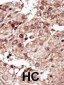 PHKG1 Antibody (Center)