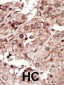 PHKG1 Antibody (Center)