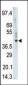 PHKG1 Antibody (Center)