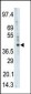 PHKG1 Antibody (Center)