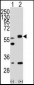 STK11 (LKB1) Antibody (N-term I29)