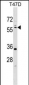 STK11 (LKB1) Antibody (N-term I29)