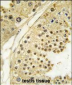 Aurora-B (ARK/STK12) Antibody (N-term)