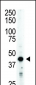 Aurora-B (ARK/STK12) Antibody (Center)