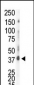 CSNK1D Antibody (C-term)