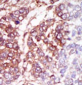 CSNK1G3 Antibody (C-term)