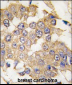 MAPK1 Antibody (C-term)