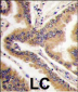MAPK13 Antibody (C-term)