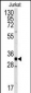 CDK2 Antibody (C-term)