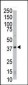 CDK4 Antibody (C-term)