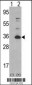 CDK4 Antibody (C-term)