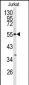 CDK8 Antibody (N-term)