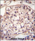 DYRK2 Antibody (N-term)