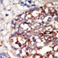 DYRK1B Antibody (C-term)
