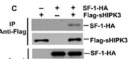 HIPK3 Antibody (C-term)