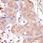 MAK Antibody (C-term)