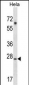 SRPK1 Antibody (N-term)