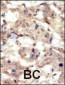 EphB6 Antibody (N-term S45)