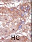 ACK1 Antibody (C-term)