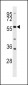 BLK Antibody (N-term)