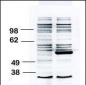 BLK Antibody (N-term)