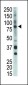 BMX Antibody (Center)