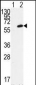 FGR Antibody (N-term)