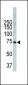 ITK Antibody (Center)