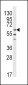 LYN Antibody (N-term)