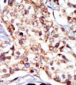 SRC Antibody (N-term)