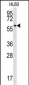 SRMS Antibody (N-term)