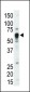 TEC Antibody (Center)