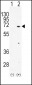 TXK Antibody (N-term)