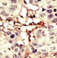 TYK2 Antibody (N-term)
