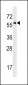 Activin Receptor Type IA (ACVR1) Antibody (Center R147)