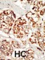 KSR1 Antibody (N-term A7)