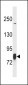 LIM Kinase 1 (LIMK1) Antibody (N-term)