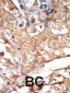 RAF1 Antibody (N-term)