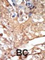 RAF1 Antibody (N-term)