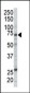 RAF1 Antibody (N-term)