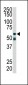 RIPK2 Antibody (C-term)