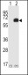 RIPK2 Antibody (C-term)